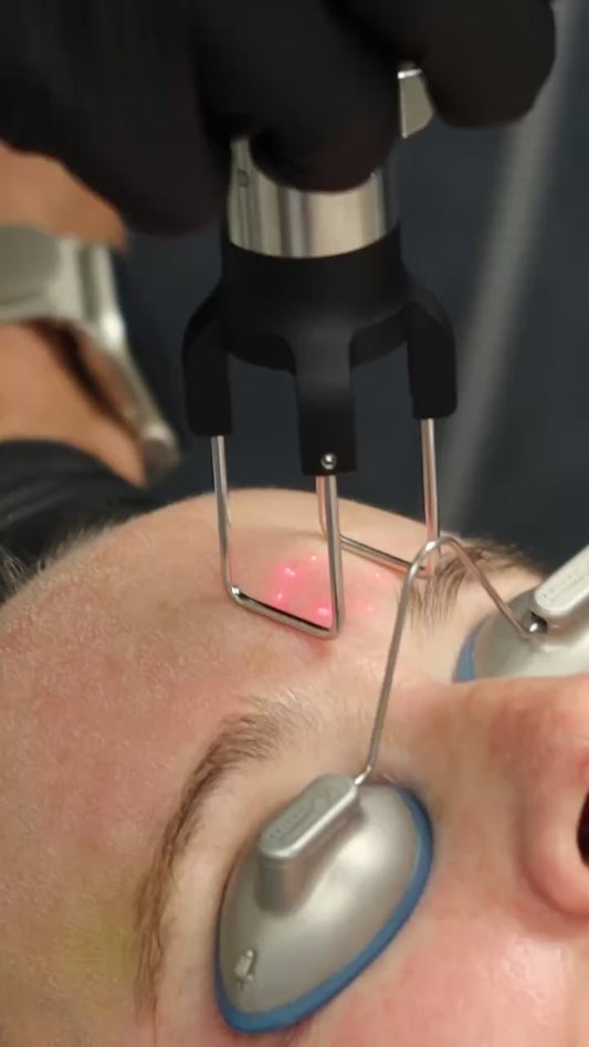 Time Rewind CO₂ CoolPeel Laser Renewal Series of 3 + Skincare Set